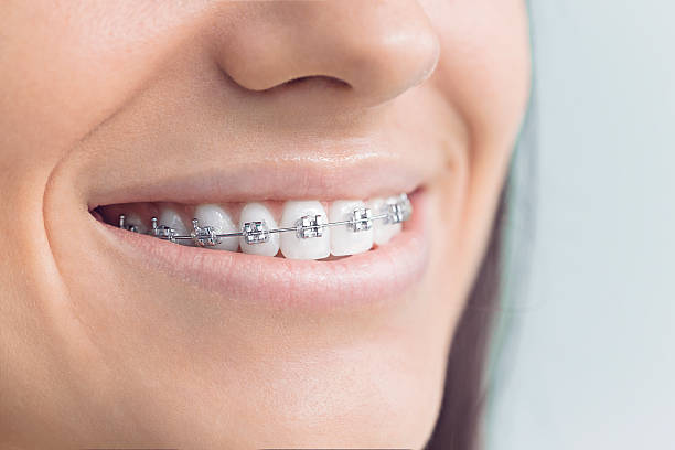 Dental Inlays and Onlays in Kingston Springs, TN